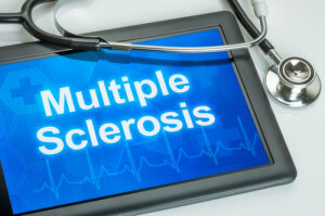 Umbilical Cord Tissue being used to treat Multiple Sclerosis