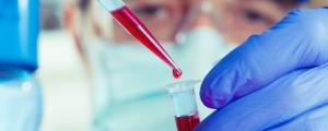 Could Cord Blood Treat Cerebral Palsy?