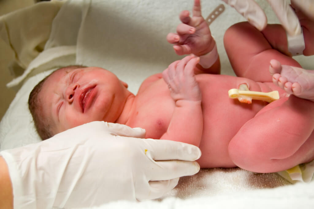 5 things to think about when banking your baby's stem cells